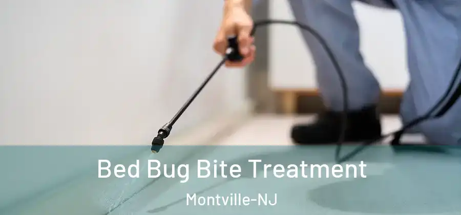 Bed Bug Bite Treatment Montville-NJ
